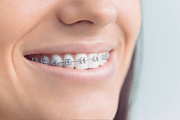 Best Dental Fillings (Composite and Amalgam)  in Lake In The Hls, IL